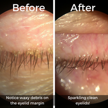 Load image into Gallery viewer, Tea Tree Eyelid Cleansing Oil
